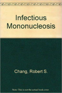 Infectious mononucleosis