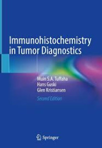 Image of Immunohistichemistry in Tumor Diagnostics