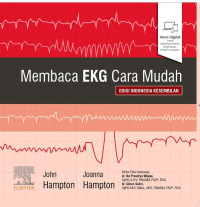 Image of Membaca EKG Cara Mudah